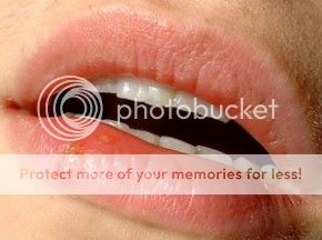 How To Get Rid Of Canker Sores (c) HowToGetRidOfCankerSores canker sores
